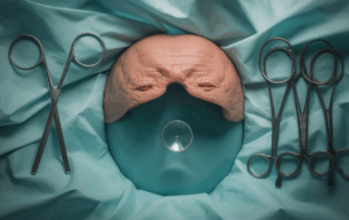 Surgical Error Claims in Cape Coral: What Patients Need to Know