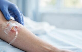 IV extravasation injury